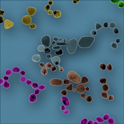 TEM de nanopartculas de ouro em grade de cobre e carbono, colorizada usando Photoshop.