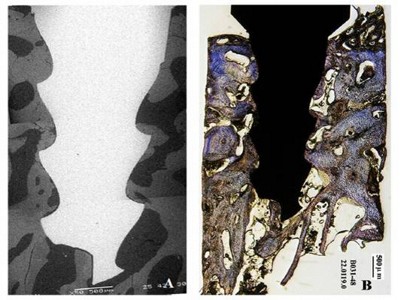 Evaluation of surface treatment in dental implant.