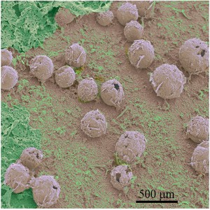 Microestruturas de polipirrol eletrodepositado sobre aço inox. 